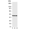 Western blot testing of CD1a antibody and Lane 1: Jurkat; 2: SW620; 3: CEM cell lysate. Predicted molecular weight: 37~49 kDa.