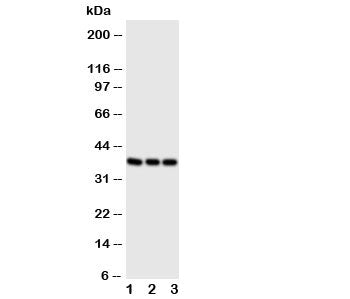 Western blot testing of CD1a antibody and Lane 1: Jurkat; 2: SW620; 3: CEM cell lysate. Predicted molecular weight: 37~49 kDa.