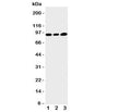 Western blot testing of TRPV3 antibody and Lane 1: HeLa; 2: A549; 3: MCF-7 cell lysate. Predicted/observed size ~90KD