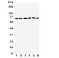 Western blot testing of RSK1 antbody; Lane 1: MCF-7; 2: HeLa; 3: K562; 4: Jurkat; 5: SW620; 6: Raji cell lysate. Predicted molecular weight: 83~90 kDa.