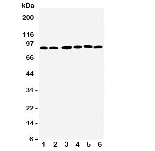 Western blot testing of RSK1 antbody; Lane 1: MCF-7; 2: HeLa; 3: K562; 4: Jurkat; 5: SW620; 6: Raji cell lysate. Predicted molecular weight: 83~90 kDa.