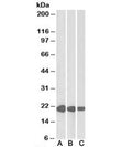 Western blot testing of human [A], mouse [B] and rat [C] heart lysate with CSRP3 antibody at 0.01ug/ml. Predicted molecular weight: ~21 kDa.