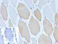 IHC staining of FFPE human skeletal muscle tissue with recombinant Myosin 7 antibody (clone MYH7/13050R). Inset: PBS used in place of primary Ab (secondary Ab negative control). HIER: boil tissue sections in pH 9 10mM Tris with 1mM EDTA for 20 min and allow to cool before testing.