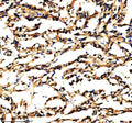 Immunohistochemical staining of PXDN using anti-PXDN antibody. PXDN was detected in a paraffin-embedded section of human renal cancer tissue. Heat mediated antigen retrieval was performed in EDTA buffer (pH 8.0, epitope retrieval solution). The tissue section was blocked with 10% goat serum. The tissue section was then incubated with 2 ug/ml rabbit anti-PXDN antibody overnight at 4oC. Peroxidase Conjugated Goat Anti-rabbit IgG was used as secondary antibody and incubated for 30 min at 37oC.