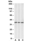 Western blot testing of human [A], mouse [B] and rat [C] heart lysates with Malate dehydrogenase 1 antibody at 0.03ug/ml. Predicted molecular weight: ~36kDa.