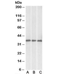 Western blot testing of human [A], mouse [B] and rat [C] heart lysates with Malate dehydrogenase 1 antibody at 0.03ug/ml. Predicted molecular weight: ~36kDa.