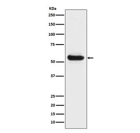 Western blot testing of human fetal liver lysate with LPL antibody. Predicted molecular weight ~53 kDa.