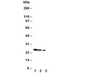 Western blot testing of Growth Hormone antibody and Lane 1: Recombinant rat GH protein 10ng; 2: 5ng; 3: 2.5ng
