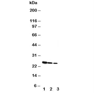 Western blot testing of Growth Hormone antibody and Lane 1: Recombinant rat GH protein 10ng; 2: 5ng; 3: 2.5ng