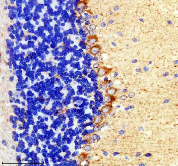 Immunohistochemical staining of TIGAR using anti-TIGAR antibody. TIGAR was detected in a paraffin-embedded section of mouse cerebellum tissue. Heat mediated antigen retrieval was performed in EDTA buffer (pH 8.0, epitope retrieval solution). The tissue section was blocked with 10% goat serum. The tissue section was then incubated with 2 ug/ml rabbit anti-TIGAR antibody overnight at 4oC. Peroxidase Conjugated Goat Anti-rabbit IgG was used as secondary antibody and incubated for 30 min at 37oC.