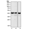 Western blot testing of 1) mouse brain, 2) mouse skin and 3) rat brain tissue lysate with TARDBP antibody. Predicted molecular weight ~45 kDa, commonly observed at 43-45 kDa.