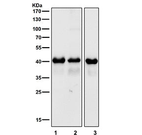 Western blot testing of 1) mouse brain, 2) mouse skin and 3) rat brain tissue lysate with TARDBP antibody. Predicted molecular weight ~45 kDa, commonly observed at 43-45 kDa.