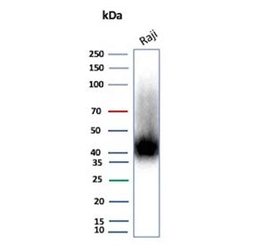 Western blot testing of human Raji cell lysate with CD38 antibody (clone rCD38/8334). Expected molecular weight: 34-46 kDa depending on glycosylation level.