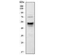 Western blot testing of mouse RAW264.7 cell lysate with Cd14 antibody. Predicted molecular weight: 40-55 kDa depending on glycosylation level.