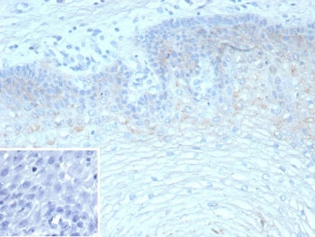 IHC staining of FFPE human esophagus tissue with recombinant Tripartite motif-containing protein 29 antibody (clone TRIM29/9257R). Inset: PBS used in place of primary Ab (secondary Ab negative control). HIER: boil tissue sections in pH 9 10mM Tris with 1mM EDTA for 20 min and allow to cool before testing.