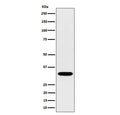 Western blot testing of human Jurkat cell lysate with TSFM antibody. Predicted molecular weight ~35 kDa.