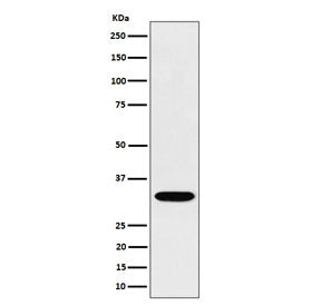 Western blot testing of human Jurkat cell lysate with TSFM antibody. Predicted molecular weight ~35 kDa.