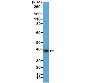 Western blot testing of human K562 cell lysate with recombinant ANXA1 antibody at 1:2000 dilution. Predicted molecular weight ~36 kDa.