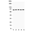 Western blot testing of HIF-1 beta antibody and Lane 1: HeLa; 2: 293T; 3: Jurkat; 4: U87; Lane5: COLO320. Expected/observed size ~87KD