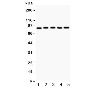 Western blot testing of HIF-1 beta antibody and Lane 1: HeLa; 2: 293T; 3: Jurkat; 4: U87; Lane5: COLO320. Expected/observed size ~87KD