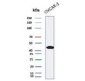 Western blot testing of human OVCAR-3 cell lysate with Mesothelin antibody (clone MSLN/2132). Predicted molecular weight ~69 kDa (precursor), ~40 kDa (cleaved form). Glycosylation may make the protein run higher than expected.