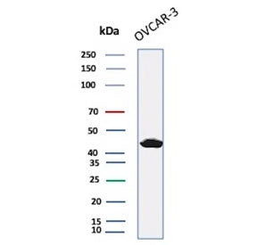 Western blot testing of human OVCAR-3 cell lysate with Mesothelin antibody (clone MSLN/2132). Predicted molecular weight ~69 kDa (precursor), ~40 kDa (cleaved form). Glycosylation may make the protein run higher than expected.