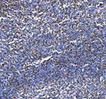 IHC staining of FFPE human tonsil tissue with Aiolos antibody. HIER: boil tissue sections in pH8 EDTA for 20 min and allow to cool before testing.