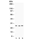 Western blot testing of 1) rat brain, 2) mouse testis and 3) human SW620 lysate with SIP antibody. Expected/observed molecular weight ~26 kDa.