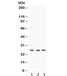 Western blot testing of 1) rat brain, 2) mouse testis and 3) human SW620 lysate with SIP antibody. Expected/observed molecular weight ~26 kDa.