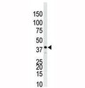 p38 antibody used in western blot to detect p38 in Jurkat cell lysate