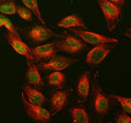 Immunofluorescent staining of FFPE human U-2 OS cells with Dnmt1 antibody (green) and Alpha Tubulin mAb (red). HIER: steam section in pH6 citrate buffer for 20 min.