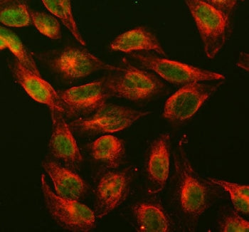 Immunofluorescent staining of FFPE human U-2 OS cells with Dnmt1 antibody (green) and Alpha Tubulin mAb (red). HIER: steam section in pH6 citrate buffer for 20 min.