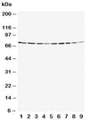 Western blot testing of Annexin VI antibody and Lane 1: rat ovary; 2: rat liver; 3: rat intestinum tenue; 4: rat brain; 5: human A549; 6: human Jurkat; 7: human Raji; 8: human CCRF-CEM; 9: human SMMC-7721 cell lysate. Expected molecular weight: 67-76 kDa.