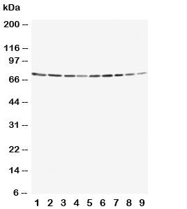 Western blot testing of Annexin VI antibody and Lane 1: rat ovary; 2: rat liver; 3: rat intestinum tenue; 4: rat brain; 5: human A549; 6: human Jurkat; 7: human Raji; 8: human CCRF-CEM; 9: human SMMC-7721 cell lysate. Expected molecular weight: 67-76 kDa.