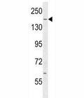 IQGAP2 antibody western blot analysis in mouse testis tissue lysate. Predicted molecular weight ~181 kDa.