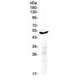 Western blot testing of human A549 cell lysate with IL6R antibody at 0.5ug/ml. Predicted molecular weight ~52 kDa.