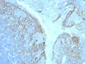 IHC staining of FFPE human tonsil tissue with CD54 / ICAM-1 antibody (clone ICAM1/8247R). HIER: boil tissue sections in pH 9 10mM Tris with 1mM EDTA for 20 min and allow to cool before testing.