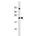Western blot testing of IL-11 antibody at 1:2000 + human DU145 cell lysate. Predicted molecular weight: 19-23 kDa.