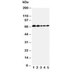 Western blot testing of Paxillin antibody and Lane 1: 293T; 2: HeLa; 3: MCF-7; 4: MM231; 5: Jurkat cell lysate. Predicted molecular weight: 61/65/66 kDa (alpha/beta/gamma).