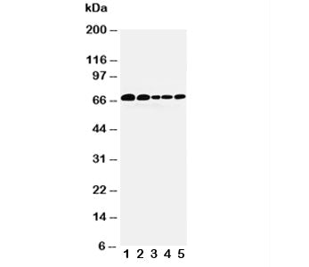 Western blot testing of Paxillin antibody and Lane 1: 293T; 2: HeLa; 3: MCF-7; 4: MM231; 5: Jurkat cell lysate. Predicted molecular weight: 61/65/66 kDa (alpha/beta/gamma).