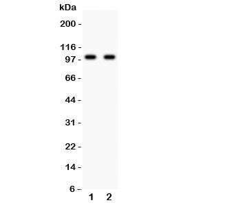 Western blot testing of GLUR4 antibody and Lane 1: rat brain; 2: mouse brain lysate. Predicted/observed molecular weight: ~101 kDa.