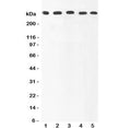 Western blot testing of Ki67 antibody and human samples 1: HeLa; 2: MCF-7; 3: COLO320; 4: HEPG2; 5: SKOV lysate. Predicted molecular weight ~350 kDa.