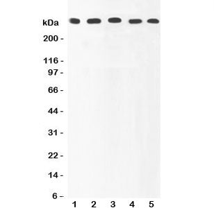 Western blot testing of Ki67 antibody and human samples 1: HeLa; 2: MCF-7; 3: COLO320; 4: HEPG2; 5: SKOV lysate. Predicted molecular weight ~350 kDa.
