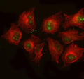 Immunofluorescent staining of S100P using anti-S100P antibody (green) and anti-Beta Tubulin antibody (red). S100P was detected in immunocytochemical section of cell. Enzyme antigen retrieval was performed using IHC enzyme antigen retrieval reagent for 15 mins. The cells were blocked with 10% goat serum. And then incubated with 5 ug/ml rabbit anti-S100P antibody and mouse anti-Beta Tubulin antibody overnight at 4oC. DyLight 488 Conjugated Goat Anti-Rabbit IgG and DyLight 594 Conjugated Goat Anti-Mouse IgG we