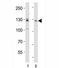 Western blot analysis of lysate from (1) A431 and (2) U-87 MG cell line using EPHA2 antibody diluted at 1:1000. Expected molecular weight: 108~130 kDa.