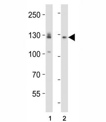Western blot analysis of lysate from (1) A431 and (2) U-87 MG cell line using EPHA2 antibody diluted at 1:1000. Expected molecular weight: 108~130 kDa.