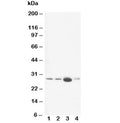 Western blot testing of Calbindin antibody and Lane 1: rat brain; 2: rat brain; 3: rat kidney; 4: rat lung tissue lysate. Expected molecular weight: 27-28 kDa.