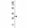 Myogenin antibody western blot analysis in ZR-75-1 lysate. Predicted molecular weight ~25 kDa, routinely observed at ~34 kDa.