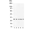 Western blot testing of TNFa antibody and rat samples: 1. PC-12, 2. spleen, 3. brain, 4. kidney, 5. liver lysate. Predicted/observed molecular weight: ~26 kDa.