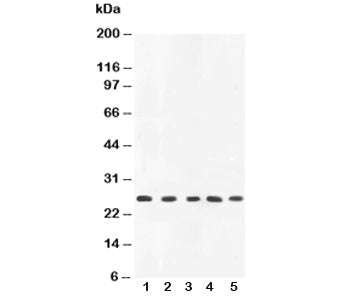 Western blot testing of TNFa antibody and rat samples: 1. PC-12, 2. spleen, 3. brain, 4. kidney, 5. liver lysate. Predicted/observed molecular weight: ~26 kDa.